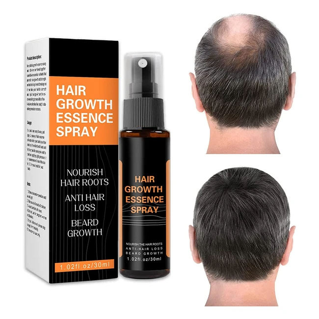 Densanti Hair Regrowth Spray - Rapid Growth Treatment for Men and Women - Natura